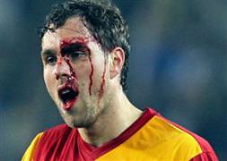 Elmander, Trabzonspor maçında yok