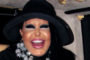 Diva kaşındı!