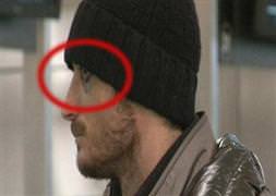 Riera'nın kavga sonrası ilk fotoğrafı