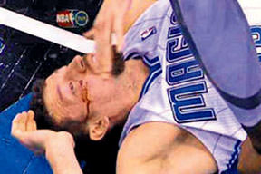 Hidayet'te kırık şüphesi