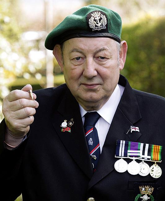 Bacağındaki 40 yıllık mermi