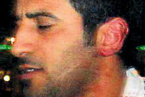 Küpeli kulağı kesildi