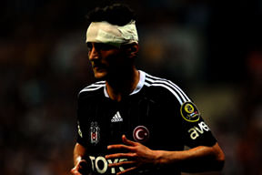 Mustafa Pektemek'e 9 dikiş atıldı