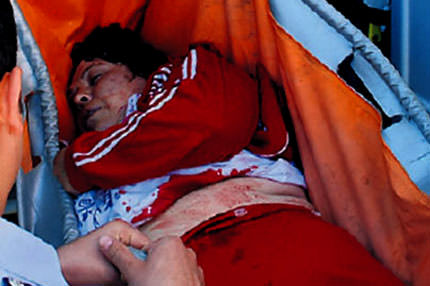 Enişte dehşet saçtı