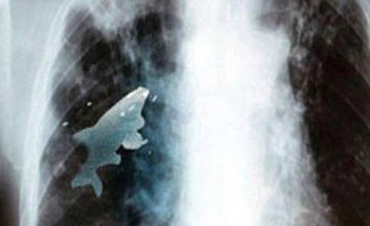 Doktorları şoke eden olay-1