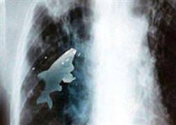 Doktorları şoke eden olay