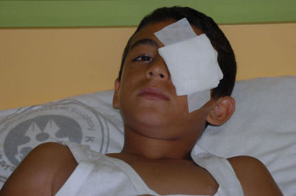 Olta gözüne saplandı