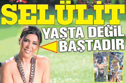 Selülit yaşta değil baştadır