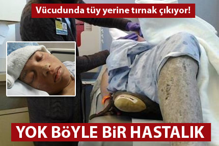 Yok böyle bir hastalık!