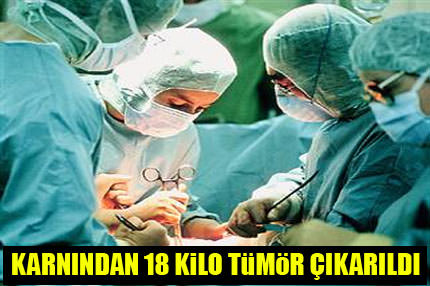 Karnından 18 kilo tümor çıkarıldı