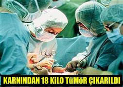 Karnından 18 kilo tümor çıkarıldı