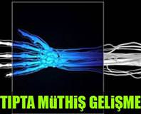 Felç hastaları için umut ışığı