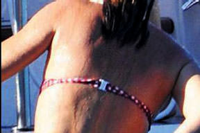 2 milyon dolarlık dövme