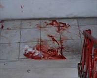 Kaçan eşini 11 kere bıçakladı