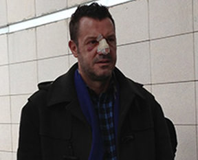 "Beni Petek'den koruyun