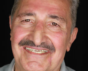 Ünlü sanatçı artık yok