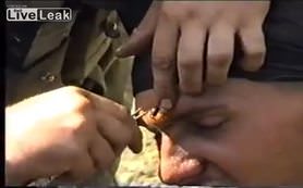 Mermi alnına saplandı