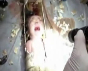 Bebeğin mucize kurtuluşu