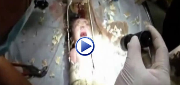 Bebeğin mucize kurtuluşu-1