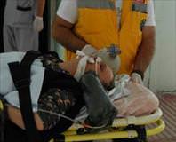 Hırsızın dövdüğü ev sahibi öldü