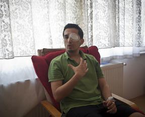 Tek göze de alışacağım!