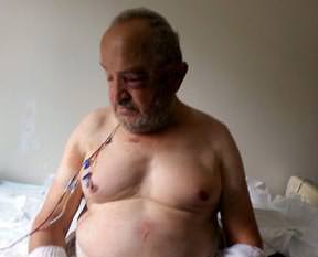 İnsanlığa neşter