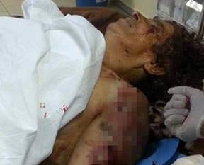 Köpekler yaşlı kadını öldürdü