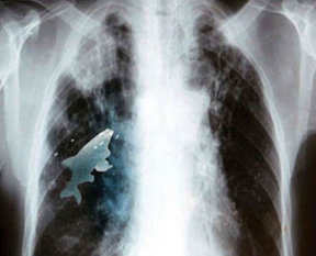 Dev piton adamı böyle yutmuş