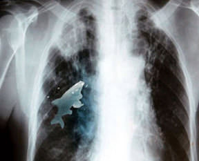 Akıl almaz röntgen görüntüleri