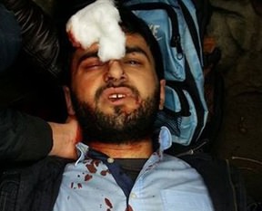 Marmara Üniversitesi’nde bıçaklı saldırı