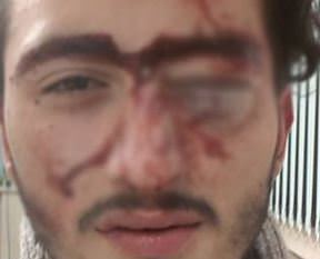 Alman polisi hastanelik etti!