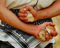 Taş atan çocuğa tedavi geliyor