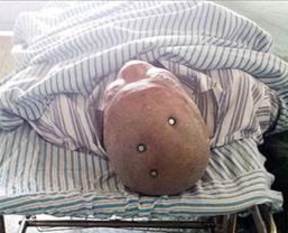 Doktorlar şoke oldu