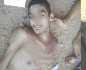 Suriye'de insanlık suçunu belgeleyen yeni fotoğraflar