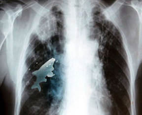 Akıl almaz röntgen görüntüleri!