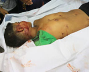 İsrail çocukları öldürmeye devam ediyor!