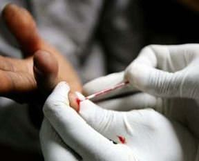 BM, AIDS raporunu açıkladı