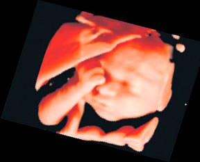 Anne karnında fotoroman