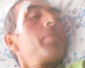 Ameliyatta felç kaldı