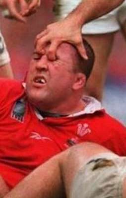 Takım arkadaşının gözünü böyle oydu