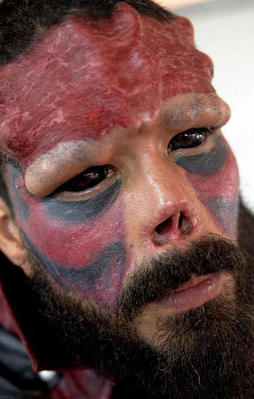 Yüzünü öyle bir hale getirdi ki...