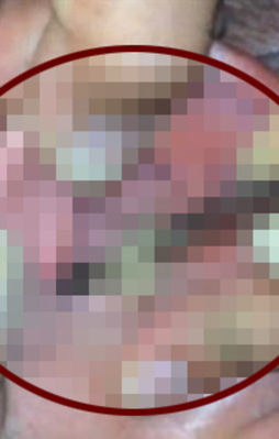 Kulağından öyle bir şey çıktı ki...