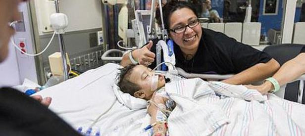 İkizler 26 saatlik operasyonla ayrıldı