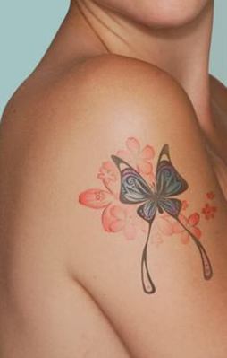 Dövme silme teknolojisinde yeni dönem