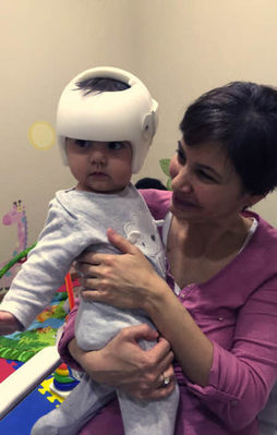 Bebeğinizin kafasını 'kask' düzeltiyor