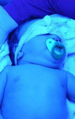 Mavi ışık hastasına "yeşil ışık"