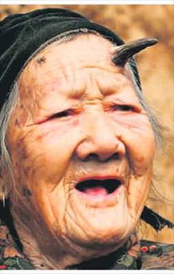 Boynuz kulağı geçti