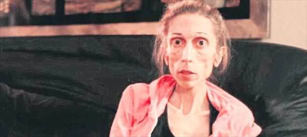 Zayıflığından ameliyat olamıyor