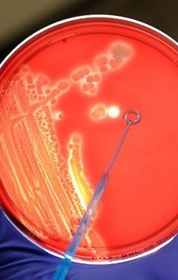ABD'de şarbon krizi büyüyor