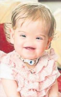 3D yazıcı ile burnuna kavuşacak